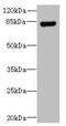 Trimethylguanosine Synthase 1 antibody, CSB-PA847219LA01HU, Cusabio, Western Blot image 