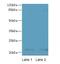 Cell Division Cycle 42 antibody, LS-C396067, Lifespan Biosciences, Western Blot image 
