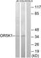 Olfactory Receptor Family 5 Subfamily K Member 1 antibody, TA315325, Origene, Western Blot image 