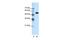 Chloride Voltage-Gated Channel Kb antibody, GTX47709, GeneTex, Western Blot image 