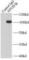 OTU Deubiquitinase 7B antibody, FNab06043, FineTest, Immunoprecipitation image 