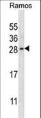 RAB21, Member RAS Oncogene Family antibody, LS-C162363, Lifespan Biosciences, Western Blot image 