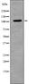 EPH Receptor A3 antibody, PA5-64785, Invitrogen Antibodies, Western Blot image 