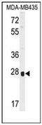 Olfactory Receptor Family 8 Subfamily B Member 4 (Gene/Pseudogene) antibody, AP53106PU-N, Origene, Western Blot image 