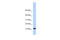 Transmembrane Protein 254 antibody, 26-461, ProSci, Western Blot image 