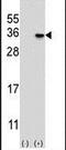 MAGE Family Member H1 antibody, PA5-13166, Invitrogen Antibodies, Western Blot image 