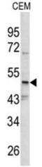 SET and MYND domain-containing protein 3 antibody, AP17751PU-N, Origene, Western Blot image 