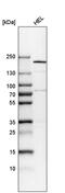 THO Complex 2 antibody, PA5-61623, Invitrogen Antibodies, Western Blot image 