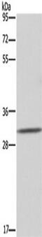 Asialoglycoprotein Receptor 1 antibody, TA349666, Origene, Western Blot image 