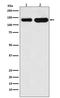 Cadherin 6 antibody, M06353, Boster Biological Technology, Western Blot image 