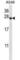 Proteasome 26S Subunit, Non-ATPase 9 antibody, abx028124, Abbexa, Western Blot image 
