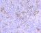 Midkine antibody, A01823-1, Boster Biological Technology, Immunohistochemistry paraffin image 