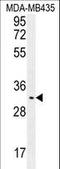 Olfactory Receptor Family 4 Subfamily K Member 2 antibody, LS-C163201, Lifespan Biosciences, Western Blot image 