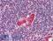 T Cell Leukemia Homeobox 1 antibody, LS-B2071, Lifespan Biosciences, Immunohistochemistry paraffin image 