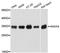Annexin A3 antibody, A12379, ABclonal Technology, Western Blot image 