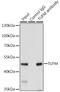 Tu Translation Elongation Factor, Mitochondrial antibody, GTX55825, GeneTex, Immunoprecipitation image 