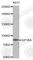 Glycoprotein Ib Platelet Subunit Alpha antibody, A1450, ABclonal Technology, Western Blot image 