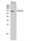 Glycoprotein V Platelet antibody, LS-C387667, Lifespan Biosciences, Western Blot image 