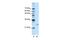 POP4 Homolog, Ribonuclease P/MRP Subunit antibody, GTX47339, GeneTex, Western Blot image 