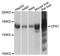 Carbamoyl-Phosphate Synthase 1 antibody, A8080, ABclonal Technology, Western Blot image 