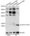 Proliferation And Apoptosis Adaptor Protein 15 antibody, LS-C750597, Lifespan Biosciences, Western Blot image 