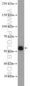 TNF Receptor Associated Factor 5 antibody, 12868-1-AP, Proteintech Group, Western Blot image 