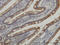 Casein Kinase 1 Gamma 1 antibody, LS-C133766, Lifespan Biosciences, Immunohistochemistry paraffin image 