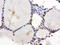 X-Ray Repair Cross Complementing 1 antibody, LS-C796710, Lifespan Biosciences, Immunohistochemistry paraffin image 