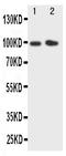 Cadherin 1 antibody, PA2078, Boster Biological Technology, Western Blot image 