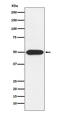 Protein Kinase CAMP-Dependent Type I Regulatory Subunit Alpha antibody, M00699-1, Boster Biological Technology, Western Blot image 