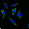 Keratin 5 antibody, LS-C812438, Lifespan Biosciences, Immunohistochemistry paraffin image 
