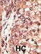 CAMP Responsive Element Binding Protein 3 Like 1 antibody, 62-191, ProSci, Immunohistochemistry paraffin image 