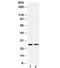 Endomucin antibody, R32349, NSJ Bioreagents, Western Blot image 