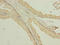 Transmembrane protein 140 antibody, LS-C396652, Lifespan Biosciences, Immunohistochemistry paraffin image 