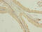 Transmembrane Protein 140 antibody, LS-C396652, Lifespan Biosciences, Immunohistochemistry paraffin image 