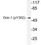 Docking Protein 1 antibody, LS-C178048, Lifespan Biosciences, Western Blot image 