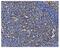 Poly(RC) Binding Protein 1 antibody, A02636-1, Boster Biological Technology, Immunohistochemistry paraffin image 