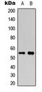 RUNX Family Transcription Factor 1 antibody, LS-C358858, Lifespan Biosciences, Western Blot image 