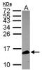 Calmodulin-like protein 5 antibody, NBP2-15668, Novus Biologicals, Western Blot image 