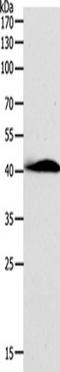 AD7C-NTP antibody, TA350627, Origene, Western Blot image 