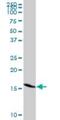 Gem Nuclear Organelle Associated Protein 7 antibody, H00079760-D01P, Novus Biologicals, Western Blot image 