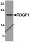 Teratocarcinoma-Derived Growth Factor 1 antibody, 7099, ProSci Inc, Western Blot image 