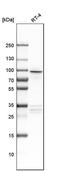 Adaptor Related Protein Complex 1 Subunit Gamma 2 antibody, PA5-52050, Invitrogen Antibodies, Western Blot image 