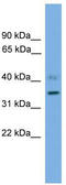 Solute Carrier Family 25 Member 48 antibody, TA340406, Origene, Western Blot image 