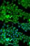 Junction Plakoglobin antibody, LS-C331167, Lifespan Biosciences, Immunofluorescence image 