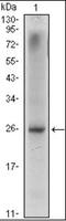 NK3 Homeobox 1 antibody, orb89450, Biorbyt, Western Blot image 