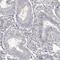 RBMX Like 2 antibody, HPA038912, Atlas Antibodies, Immunohistochemistry paraffin image 