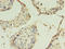 Claudin 15 antibody, LS-C369409, Lifespan Biosciences, Immunohistochemistry paraffin image 