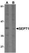 Septin 1 antibody, PA5-34399, Invitrogen Antibodies, Western Blot image 