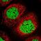 Sterile Alpha Motif Domain Containing 10 antibody, NBP1-88305, Novus Biologicals, Immunocytochemistry image 